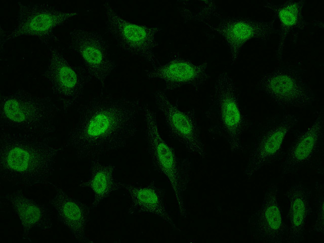 RPRD1B Antibody in Immunocytochemistry (ICC/IF)