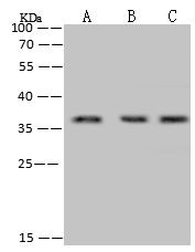 RPRD1B Antibody in Western Blot (WB)