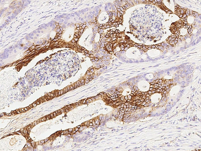 NDRG1 Antibody in Immunohistochemistry (Paraffin) (IHC (P))