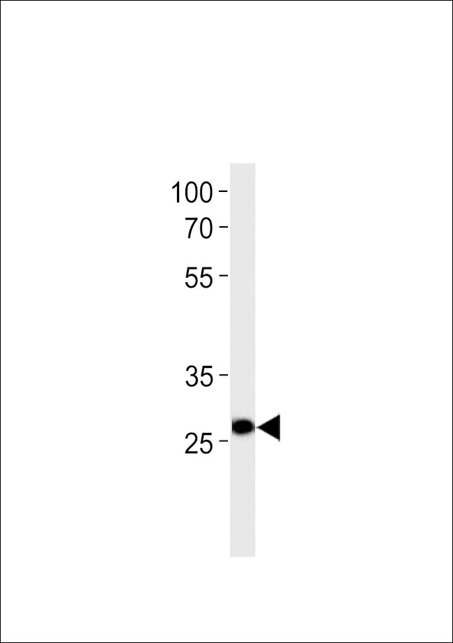 PDX1 Antibody in Western Blot (WB)