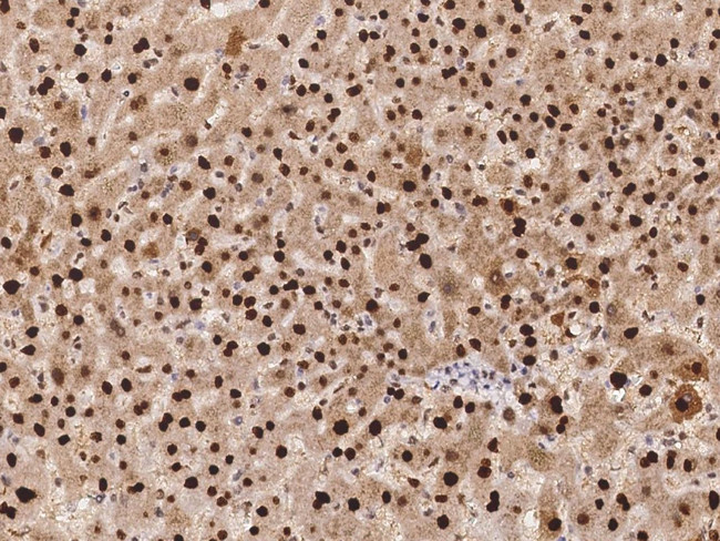 SCLY Antibody in Immunohistochemistry (Paraffin) (IHC (P))