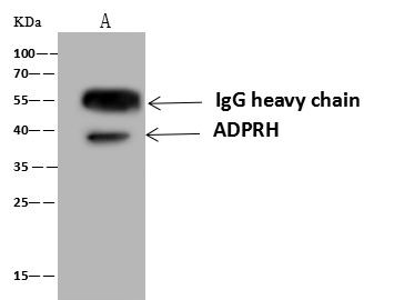 ADPRH Antibody in Immunoprecipitation (IP)