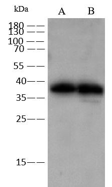 ADPRH Antibody in Western Blot (WB)