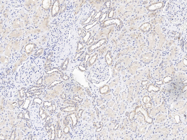 KBP Antibody in Immunohistochemistry (Paraffin) (IHC (P))