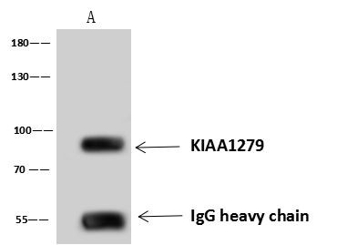 KBP Antibody in Immunoprecipitation (IP)