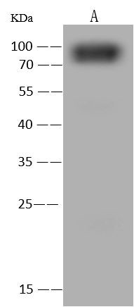 KBP Antibody in Western Blot (WB)