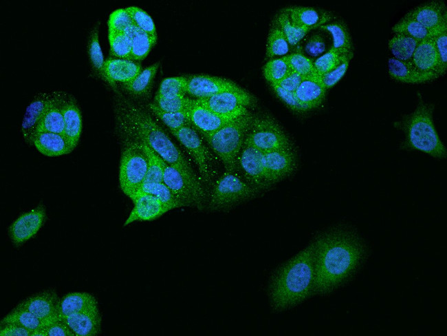 ATP6V1F Antibody in Immunocytochemistry (ICC/IF)