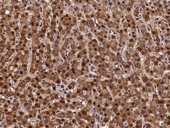 SCLY Antibody in Immunohistochemistry (Paraffin) (IHC (P))