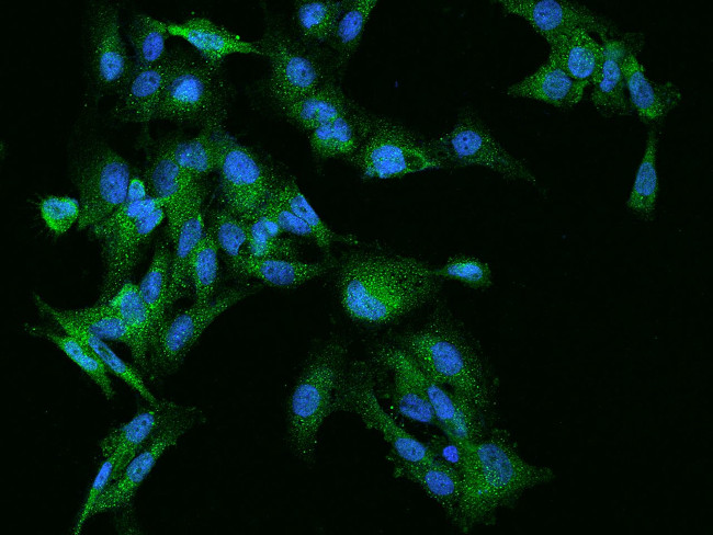 Rabex-5 Antibody in Immunocytochemistry (ICC/IF)