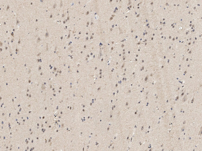 PSMD4 Antibody in Immunohistochemistry (Paraffin) (IHC (P))