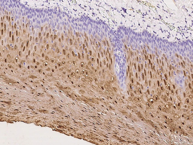 TGM3 Antibody in Immunohistochemistry (Paraffin) (IHC (P))