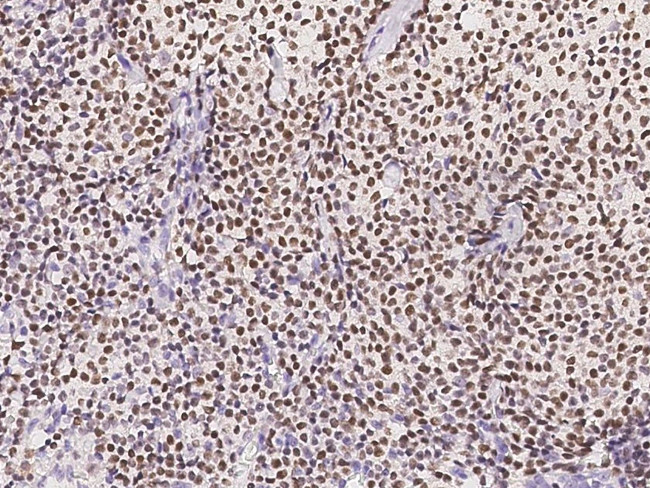 RUNX3 Antibody in Immunohistochemistry (Paraffin) (IHC (P))