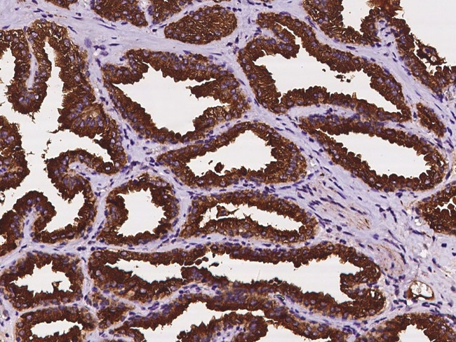 CYB561 Antibody in Immunohistochemistry (Paraffin) (IHC (P))