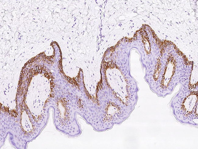 RAC3 Antibody in Immunohistochemistry (Paraffin) (IHC (P))