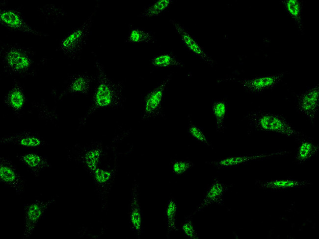 BRAF35 Antibody in Immunocytochemistry (ICC/IF)