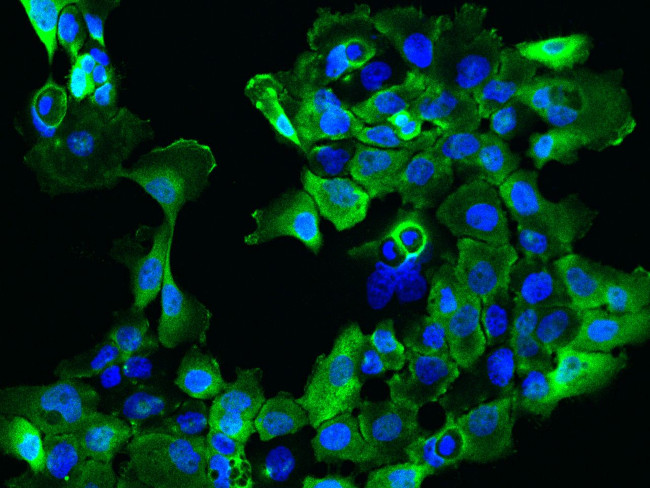 SARG Antibody in Immunocytochemistry (ICC/IF)