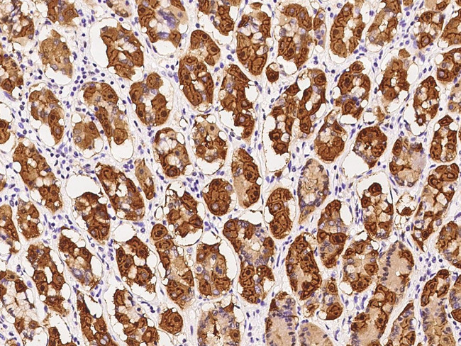 SARG Antibody in Immunohistochemistry (Paraffin) (IHC (P))