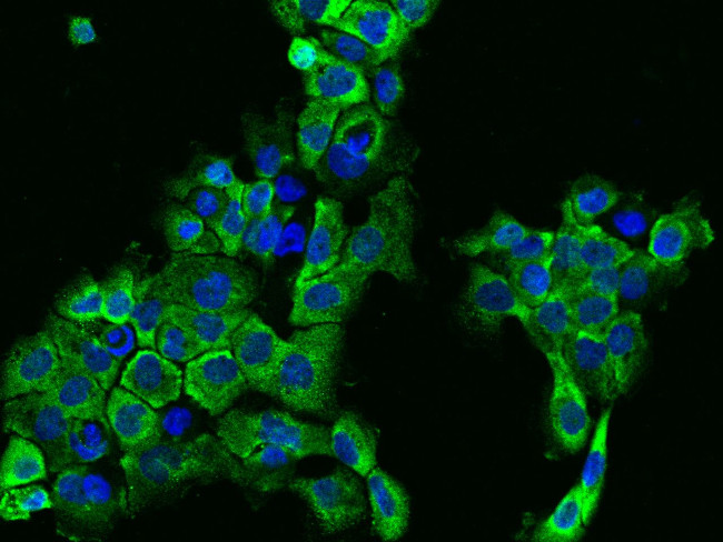 IFT122 Antibody in Immunocytochemistry (ICC/IF)