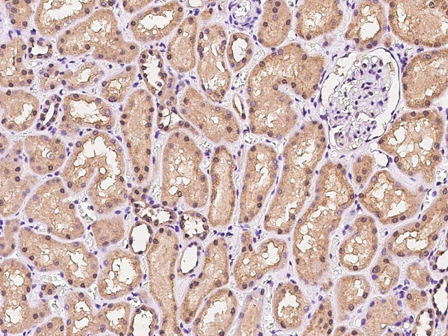 IFT122 Antibody in Immunohistochemistry (Paraffin) (IHC (P))