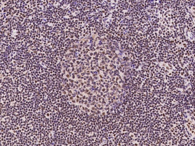 RNF113A Antibody in Immunohistochemistry (Paraffin) (IHC (P))