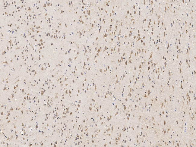 PSMD1 Antibody in Immunohistochemistry (Paraffin) (IHC (P))