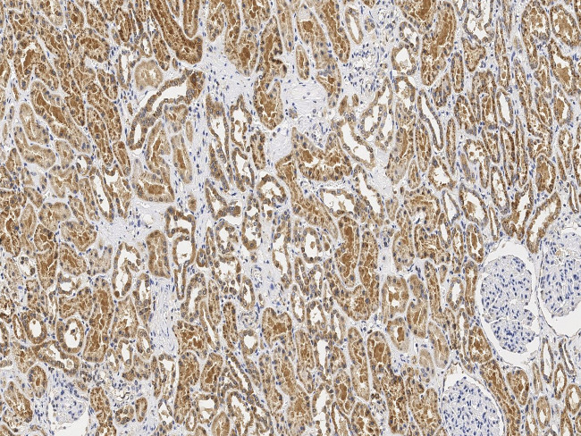 PSMD1 Antibody in Immunohistochemistry (Paraffin) (IHC (P))