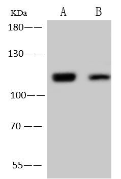 PSMD1 Antibody in Western Blot (WB)