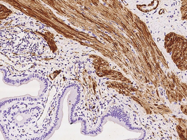 YIF1A Antibody in Immunohistochemistry (Paraffin) (IHC (P))