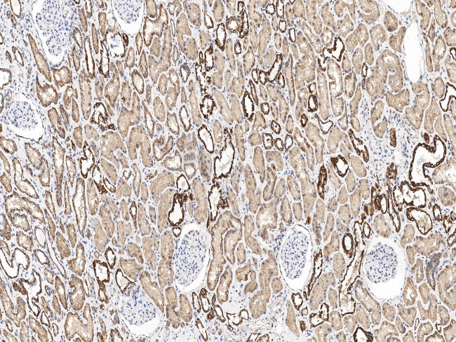 UQCRH Antibody in Immunohistochemistry (Paraffin) (IHC (P))