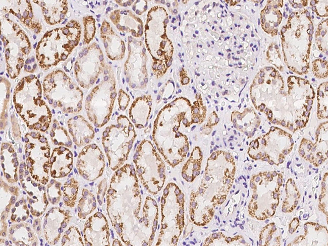 PCDH17 Antibody in Immunohistochemistry (Paraffin) (IHC (P))