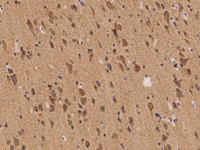 SCK Antibody in Immunohistochemistry (Paraffin) (IHC (P))