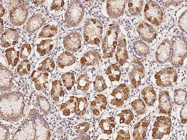 SCK Antibody in Immunohistochemistry (Paraffin) (IHC (P))