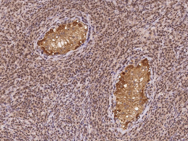 DDX53 Antibody in Immunohistochemistry (Paraffin) (IHC (P))