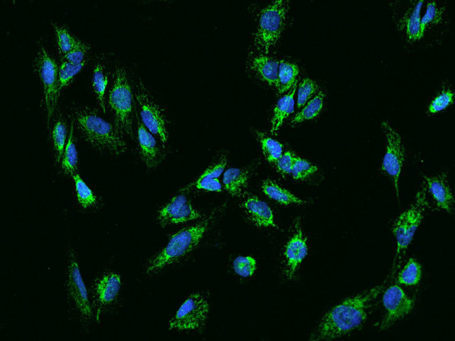 COA3 Antibody in Immunocytochemistry (ICC/IF)