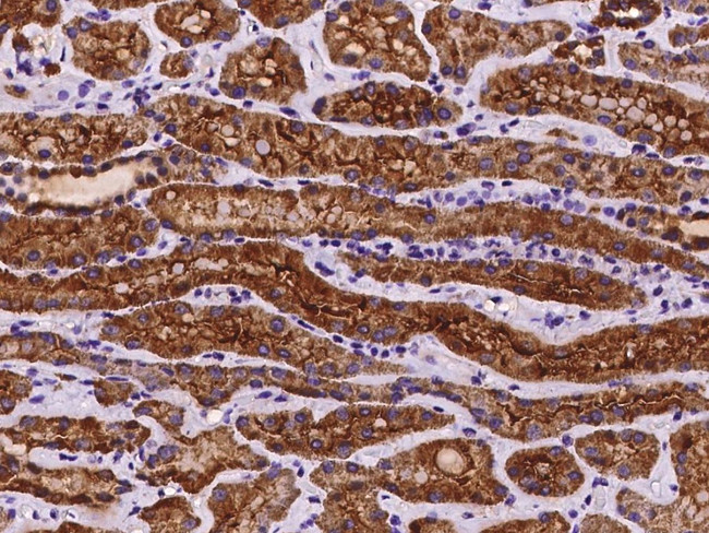 COA3 Antibody in Immunohistochemistry (Paraffin) (IHC (P))