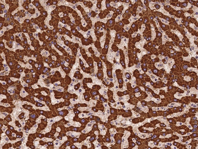 COA3 Antibody in Immunohistochemistry (Paraffin) (IHC (P))