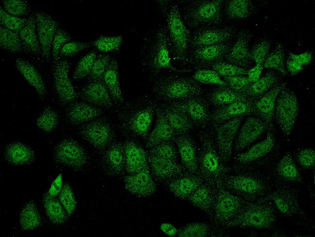 Irx5 Antibody in Immunocytochemistry (ICC/IF)