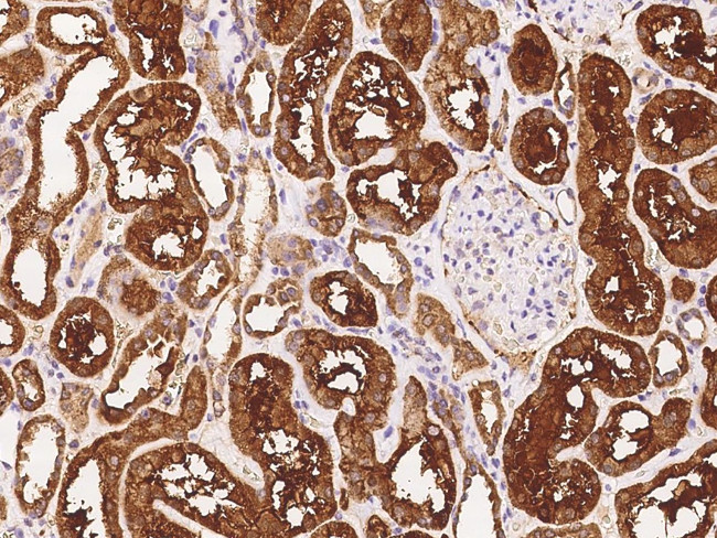 PFTK1 Antibody in Immunohistochemistry (Paraffin) (IHC (P))