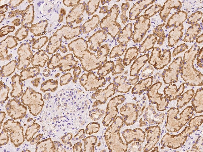 SBNO2 Antibody in Immunohistochemistry (Paraffin) (IHC (P))