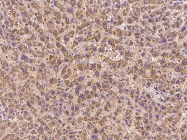 C17orf99 Antibody in Immunohistochemistry (Paraffin) (IHC (P))