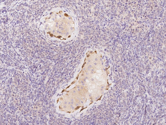 DDHD1 Antibody in Immunohistochemistry (Paraffin) (IHC (P))