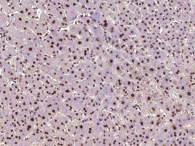 ZDHHC12 Antibody in Immunohistochemistry (Paraffin) (IHC (P))