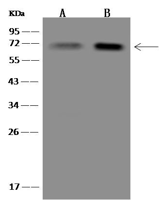 KBTBD12 Antibody in Western Blot (WB)