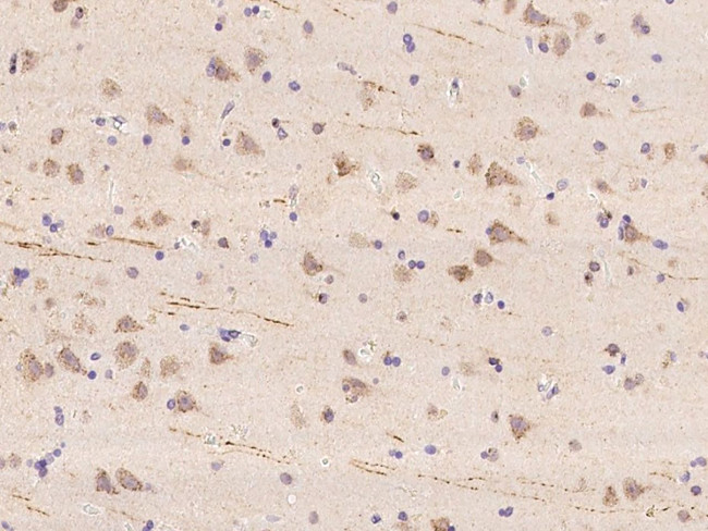 WBSCR17 Antibody in Immunohistochemistry (Paraffin) (IHC (P))