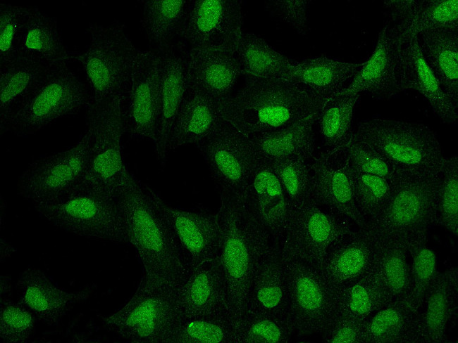 ATP8B4 Antibody in Immunocytochemistry (ICC/IF)