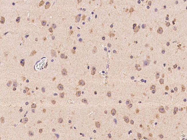 MA2 Antibody in Immunohistochemistry (Paraffin) (IHC (P))