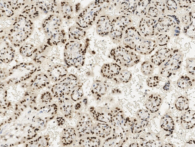 TBX3 Antibody in Immunohistochemistry (Paraffin) (IHC (P))