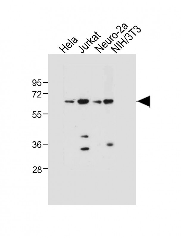 SMAD4 Antibody in Western Blot (WB)