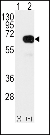 SMAD4 Antibody in Western Blot (WB)