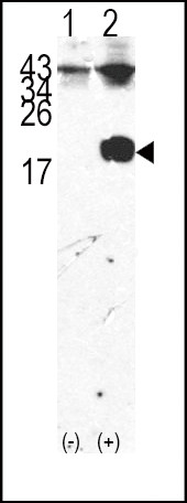 FKBP12 Antibody in Western Blot (WB)